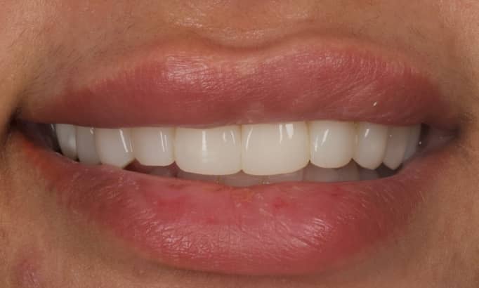 After -Revive Clinic