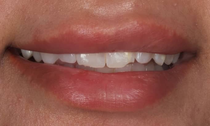 Before - Revive Clinic