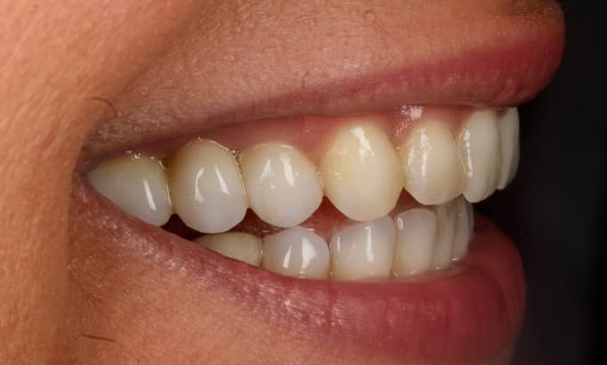 After -Revive Clinic