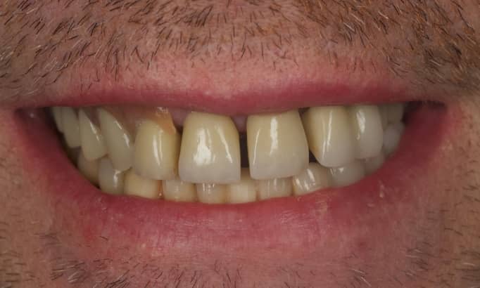 Before - Revive Clinic