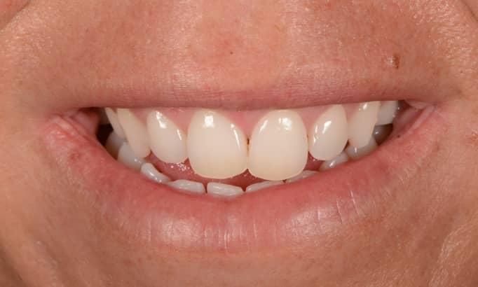 Before - Revive Clinic