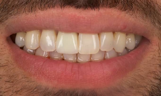 After -Revive Clinic