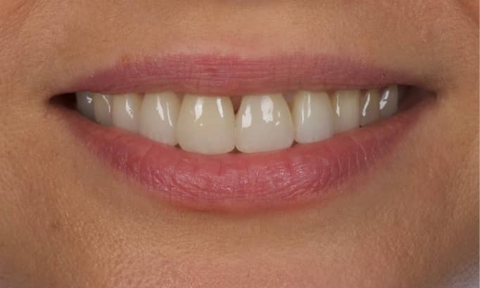 After -Revive Clinic