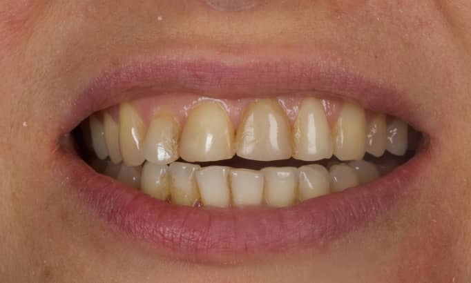 Before - Revive Clinic