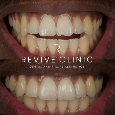 Revive Clinic
